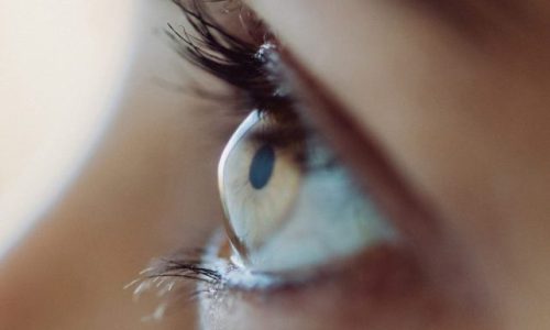 ceratocone-aspect-ratio-570-355