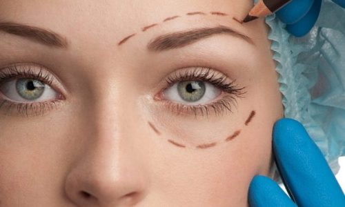 plastica_ocular_cevipa_curitiba-1024x682